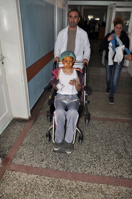 Okul laboratuvarında ispirto alev aldı, 1 öğretmen ve 2 öğrenci yaralandı