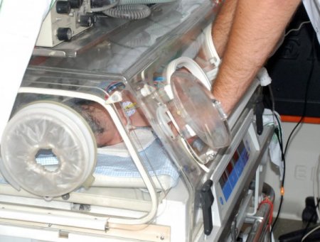 Ölen annenin karnından alınan bebek, tıp tarihine geçti