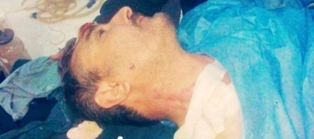 Özgür Suriye Ordusu’nun kurucusu saldırıda ağır yaralandı