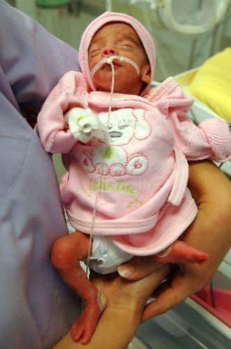 Parmak Bebek Hayata Sıkıca Tutundu