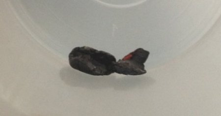 Polis vurdu denildi, vücutlarında el yapımı bombanın şarapnel parçaları çıktı