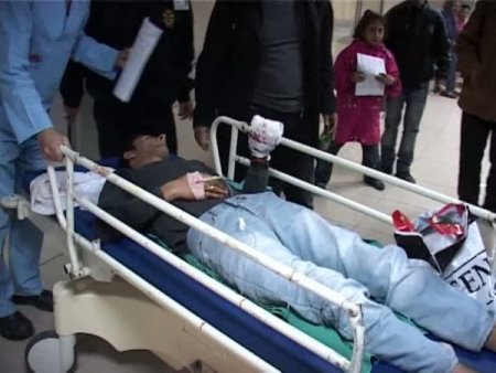 Polise Atmak İstediği Bomba Elinde Patladı