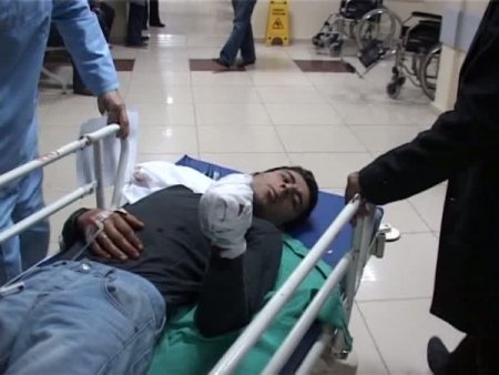 Polise Atmak İstediği Bomba Elinde Patladı