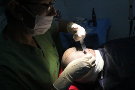 Saçı dökülen Araplar İstanbul'a koşuyor