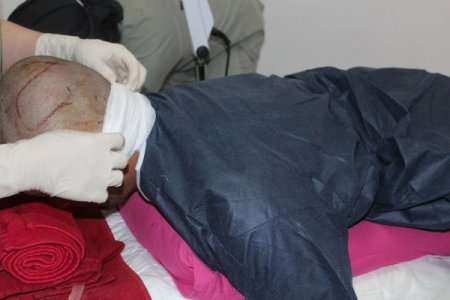 Saçı dökülen Araplar İstanbul'a koşuyor