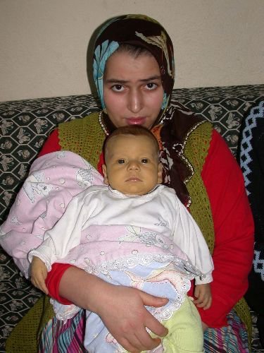 Safra Kesesisiz Doğan Berkay Bebek, Karaciğer Nakli Yapılmazsa Hayatını Kaybedecek