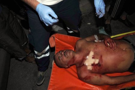 Sigara İstediler, 'Yok' Cevabını Alınca Bıçakladılar