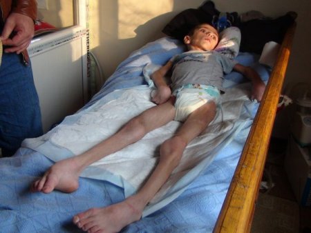 Siverekli küçük Musa, ailesinin gözü önünde eriyor