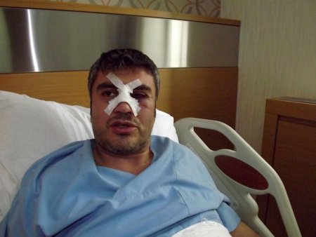 Sokağın elektriğini kesip, doktorun burnunu kırdılar