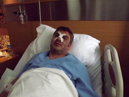 Sokağın elektriğini kesip, doktorun burnunu kırdılar