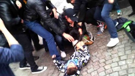 Sokak ortasında 6 yaşındaki çocuğa köpek saldırısı dehşeti