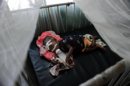 Somali’nin En Büyük Hastanesinde Her Gün 20 Çocuk Ölüyor