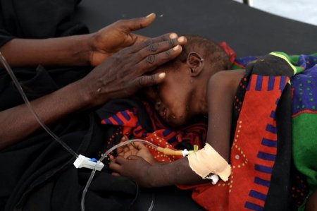 Somali’nin En Büyük Hastanesinde Her Gün 20 Çocuk Ölüyor