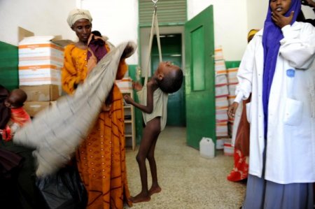 Somali’nin En Büyük Hastanesinde Her Gün 20 Çocuk Ölüyor