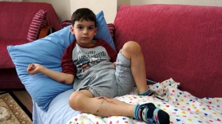 Sultanbeyli'de sokak köpeği yine bir çocuğu ısırdı