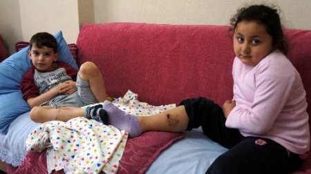 Sultanbeyli'de sokak köpeği yine bir çocuğu ısırdı