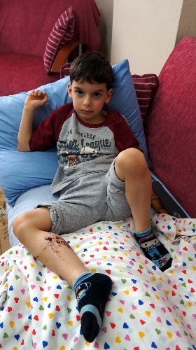 Sultanbeyli'de sokak köpeği yine bir çocuğu ısırdı