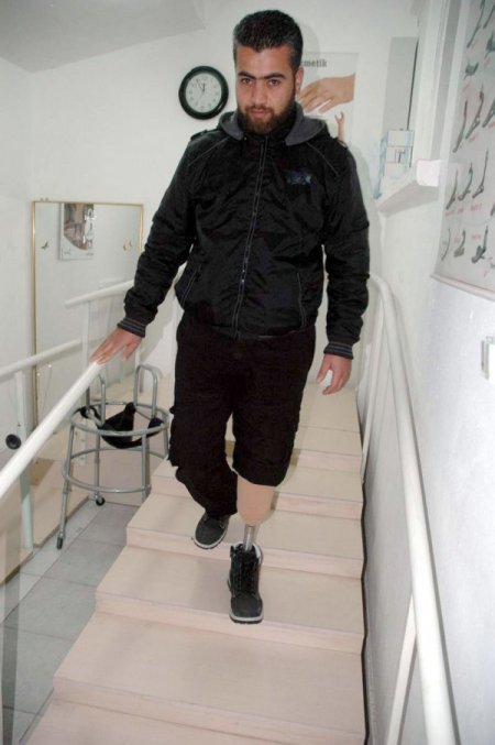 Suriye'de kaybettiği bacağına Türkiye'de protez takıldı