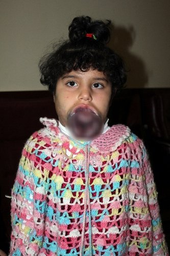 Suriye’den geldi, Kayseri’de şifa arıyor