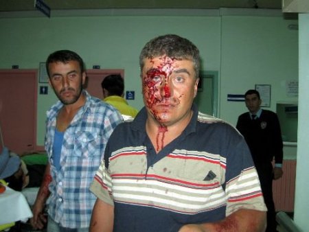 Suşehri'ndeki Kazada Hayatını Kaybedenlerin Sayısı 2'ye Çıktı