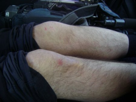 Tatlıses'in Korumalarının Saldırısına Uğrayan Cihan Kameramanı 2 Gün Rapor Aldı