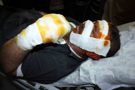 Terör Örgütü Yandaşları Lokantada Yemek Yiyen Vatandaşı Yaktı