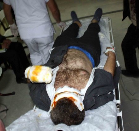 Terör Örgütü Yandaşları Lokantada Yemek Yiyen Vatandaşı Yaktı