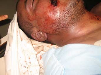 Türk genci dövülerek öldürüldü, Belçikalı gardiyanlar beraat etti