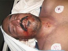 Türk genci dövülerek öldürüldü, Belçikalı gardiyanlar beraat etti