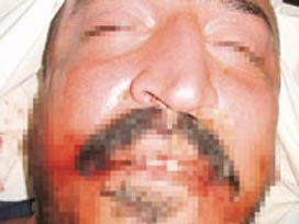 Türk genci dövülerek öldürüldü, Belçikalı gardiyanlar beraat etti