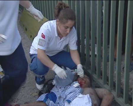 Üst Geçit Yerine Otoyolu Kullanan Çocuk Ağır Yaralandı