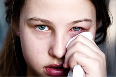 Uzmanlardan bulaşıcı hastalık uyarısı: Elinizi gözünüze sürmeyin!