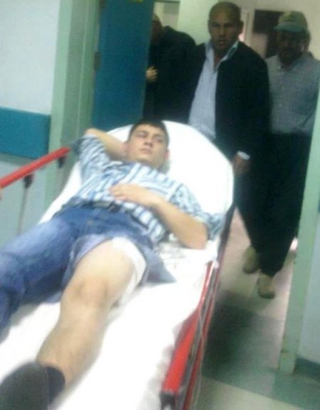 Yan baktı diye silahla bacağından vurdu