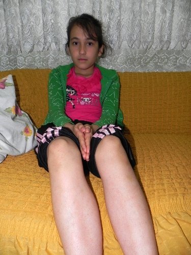 Yanlış teşhis Ankara’dan döndü