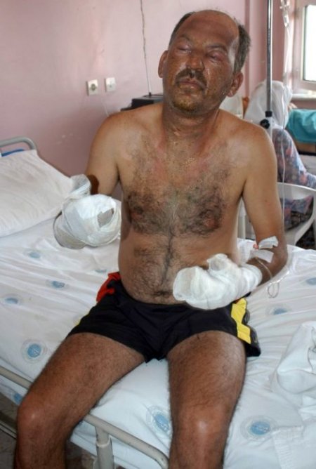 Yatağan Termik Santrali'ndeki Patlamada Bir İşçi Yaralandı