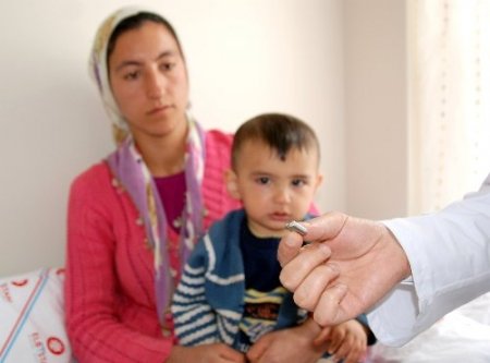 Yemek borusuna takılı anahtar parçası bulundu