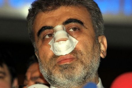 Yıldız: Kırılsa Da Dökülse De Yolumuza Devam Edeceğiz