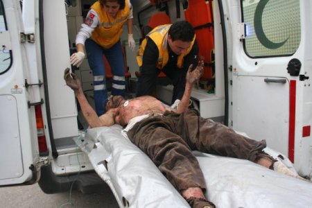 Yüksek Gerilim Hattına Kapılan 2 Kişi Ağır Yaralandı