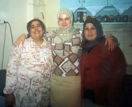 Zayıflaması İçin Bağırsakları Kısaltılan Kadın Hayatını Kaybetti