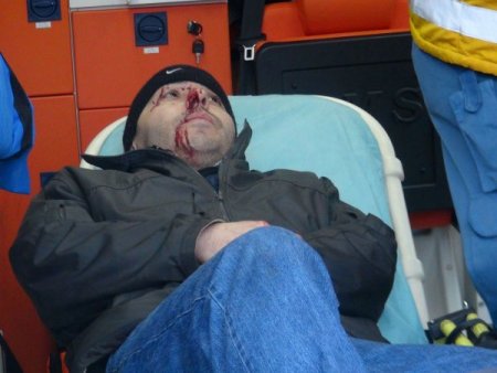 Zonguldak'ta Otomobil Dereye Uçtu: 1 Yaralı